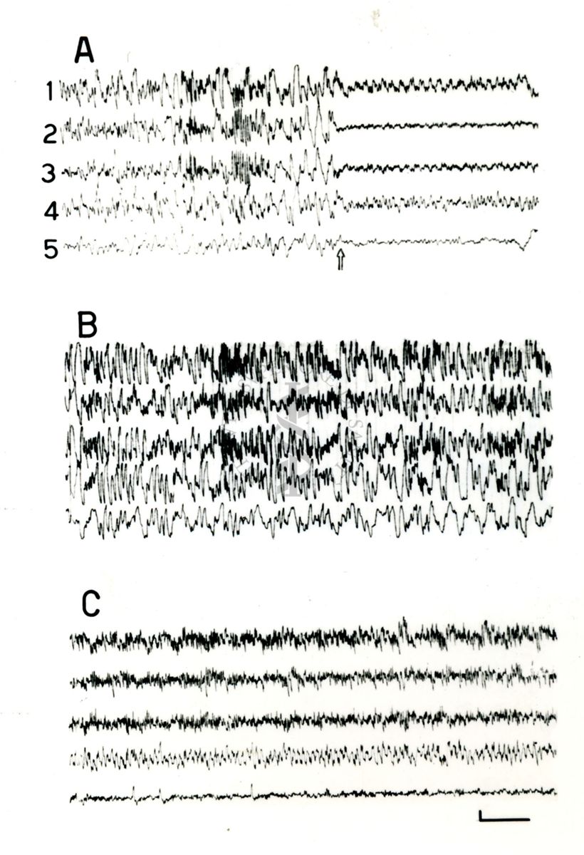 Elettroencefalogrammi di coniglio