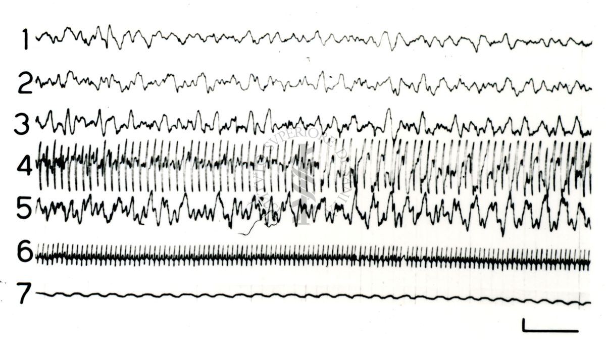 Elettroencefalogrammi di coniglio