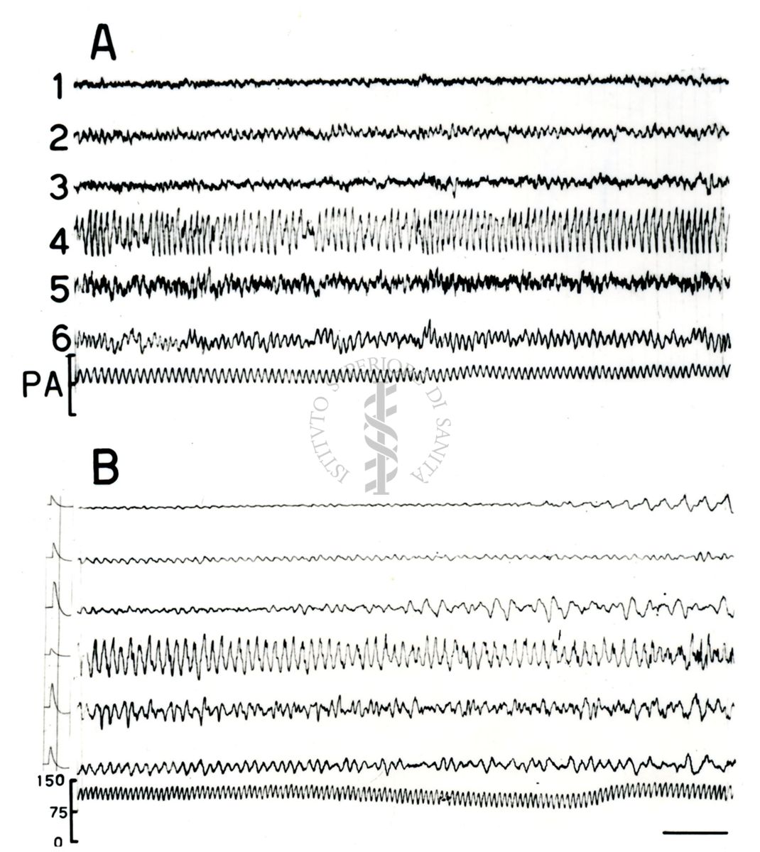 Elettroencefalogrammi di coniglio