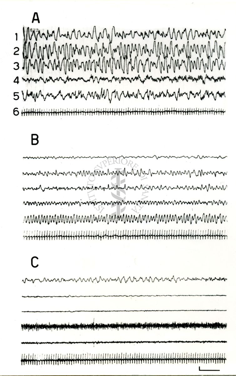 Elettroencefalogrammi di coniglio