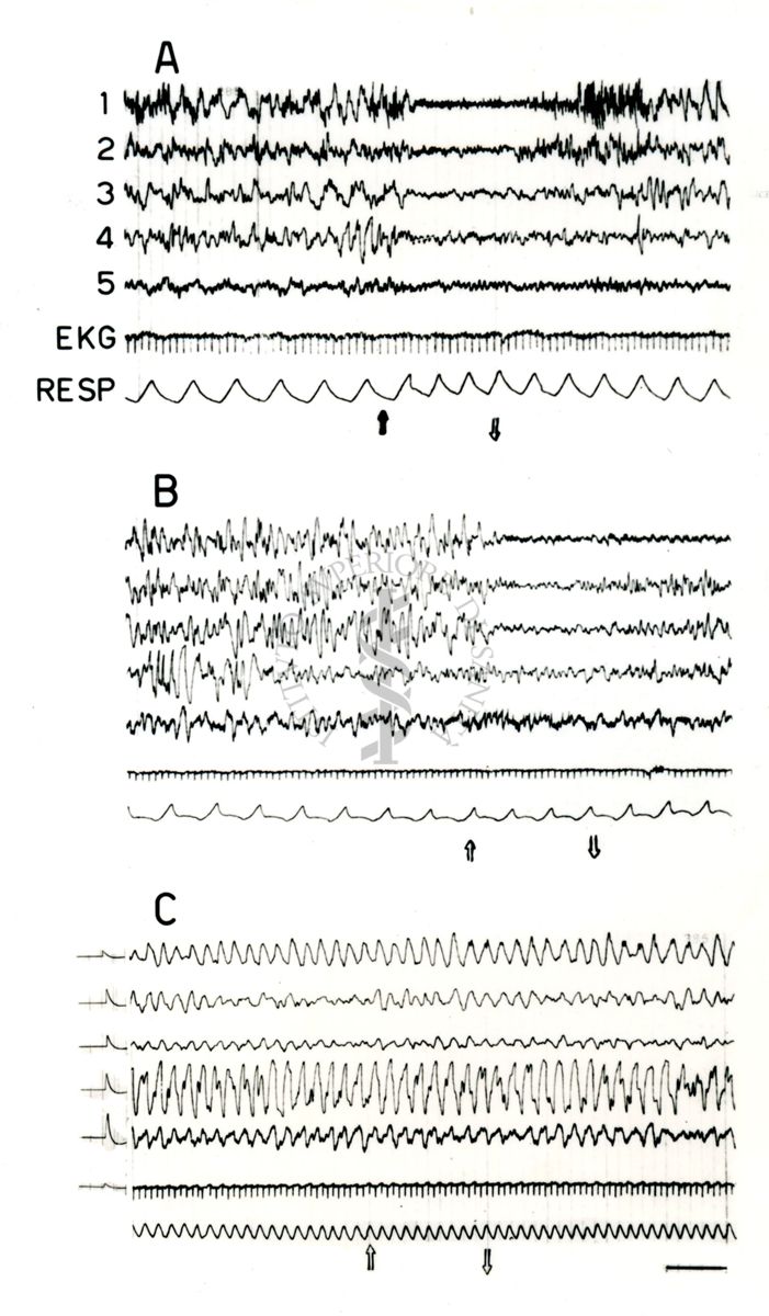 Elettroencefalogrammi di coniglio