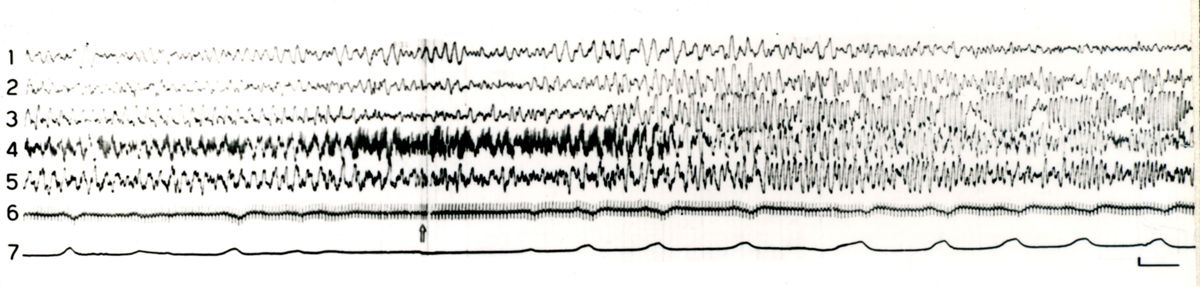 Elettroencefalogrammi di coniglio