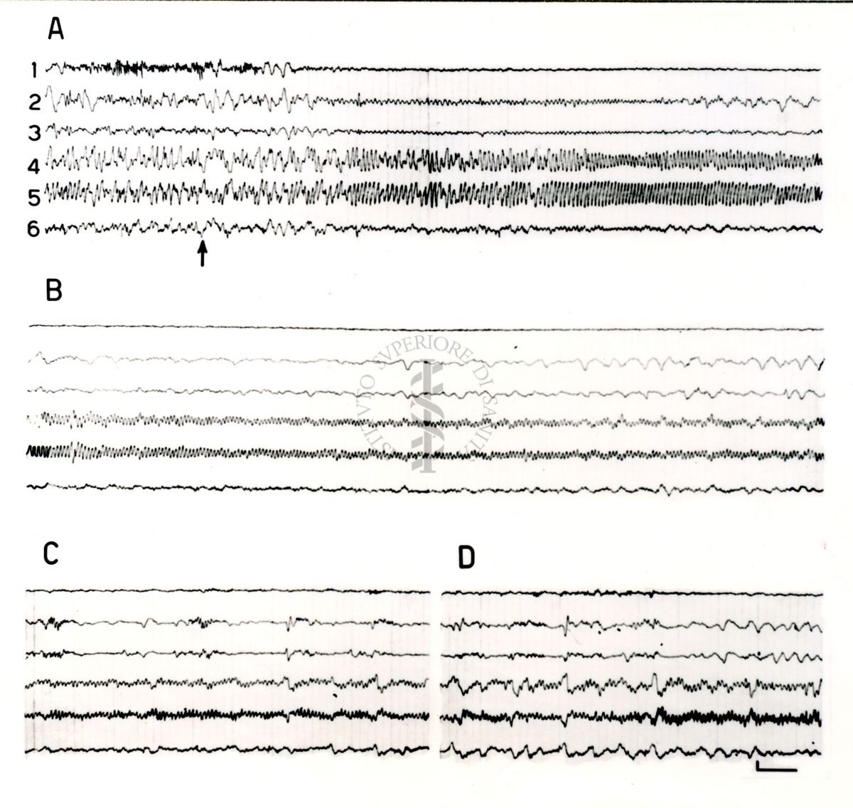 Elettroencefalogrammi di coniglio