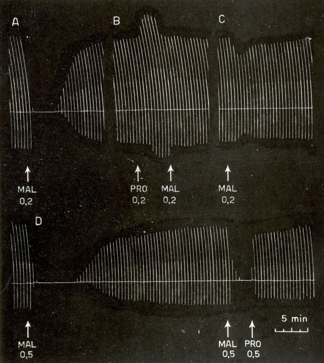 Tracciati elettroencefalografici