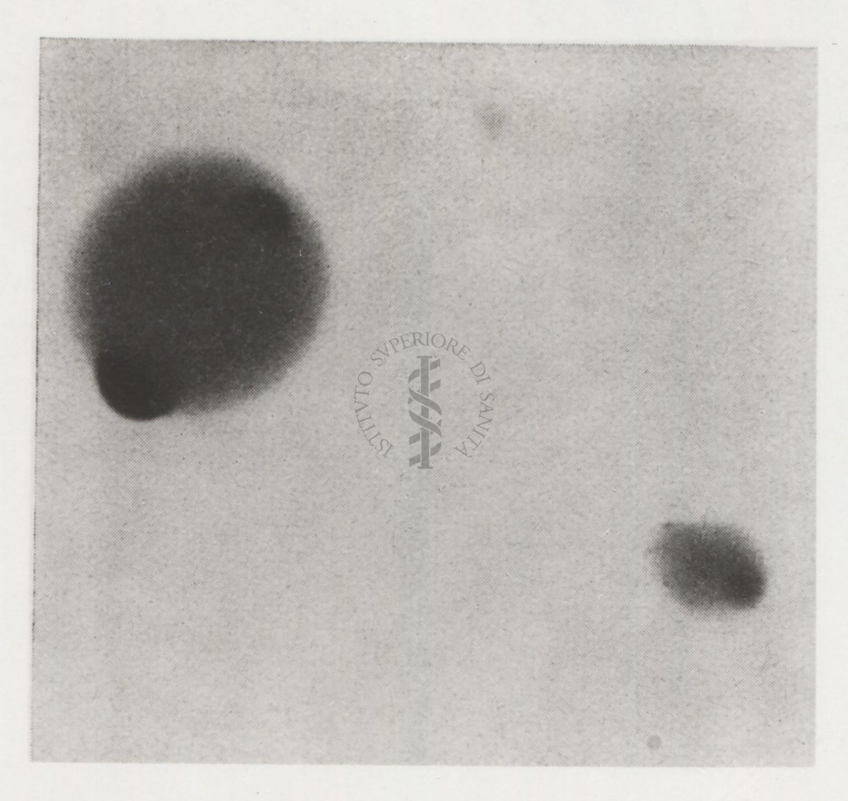 Soluzione di bianco d'uovo vista al microscopio elettronico (G. Riedel e H. Ruska)