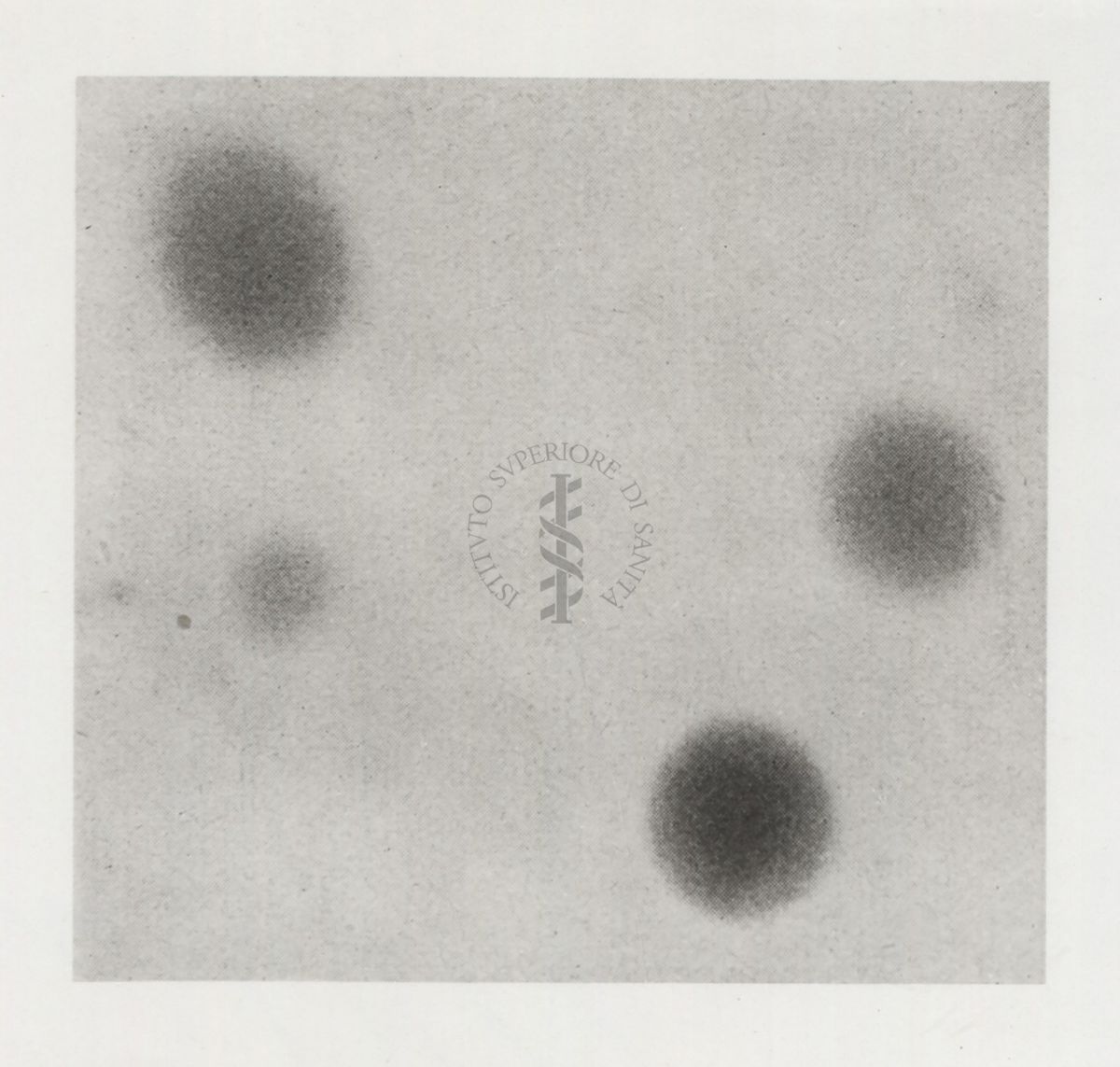 Soluzione di bianco d'uovo vista al microscopio elettronico (G. Riedel e H. Ruska)