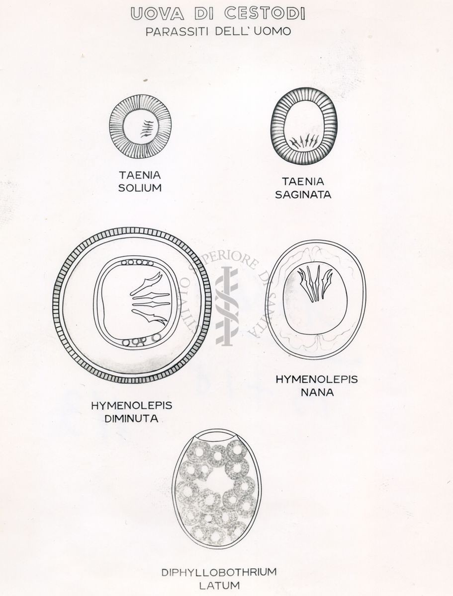 Immagini raffiguranti uova di Trematodi (parassiti dell'uomo)