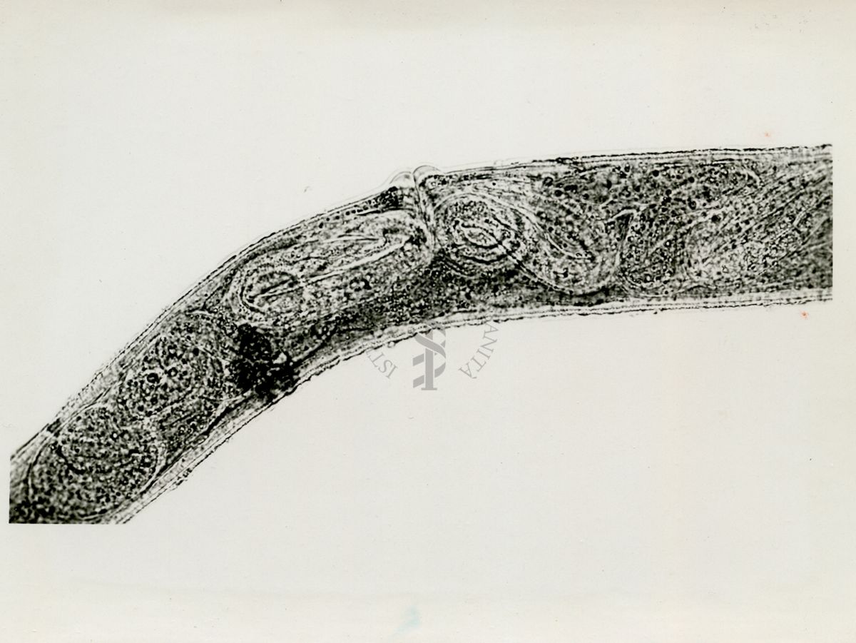 Cheilobus Russo (Penso 1941) - Parassita delle patate. Porzione ventrale di femmina poco prima del parto. Numerosi embrioni liberi nella cavità uterina