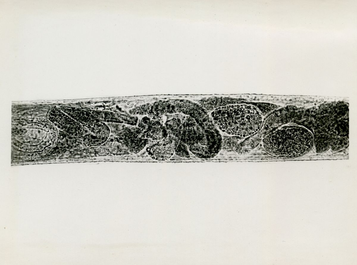 Cheilobus Russo (Penso 1941) - Parassita delle patate. Larve libere nell'interno dell'utero