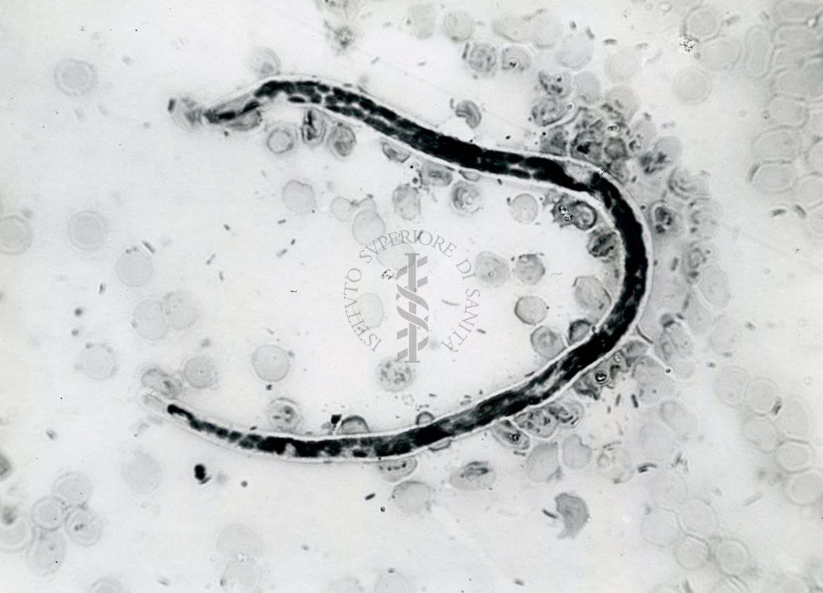 Microfilaria