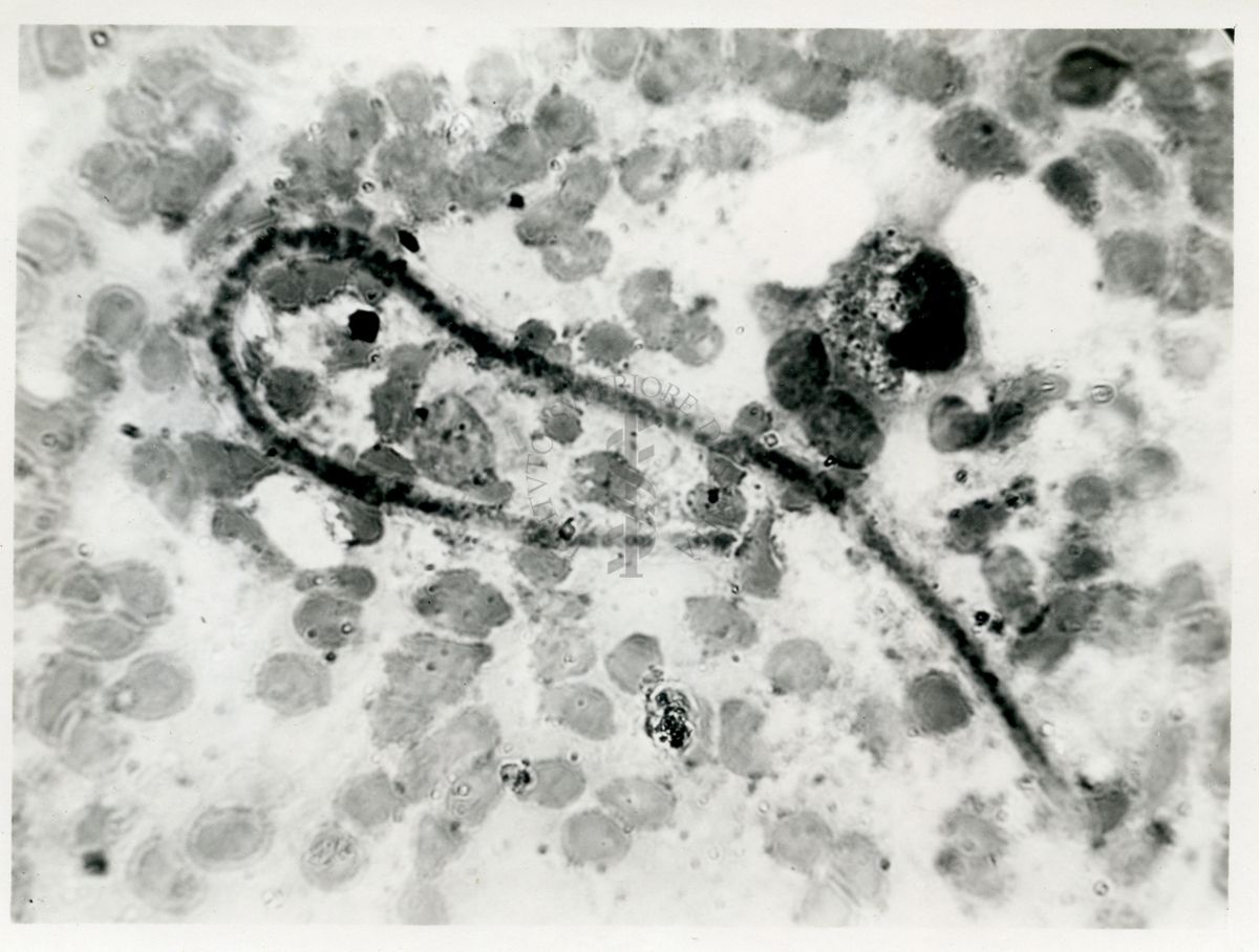 Microfilaria