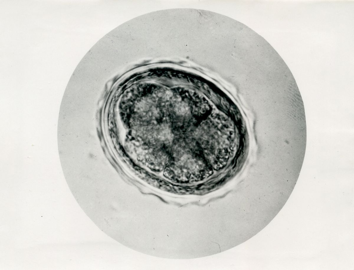 Ciclo di sviluppo dell'Ascaris lumbricoides