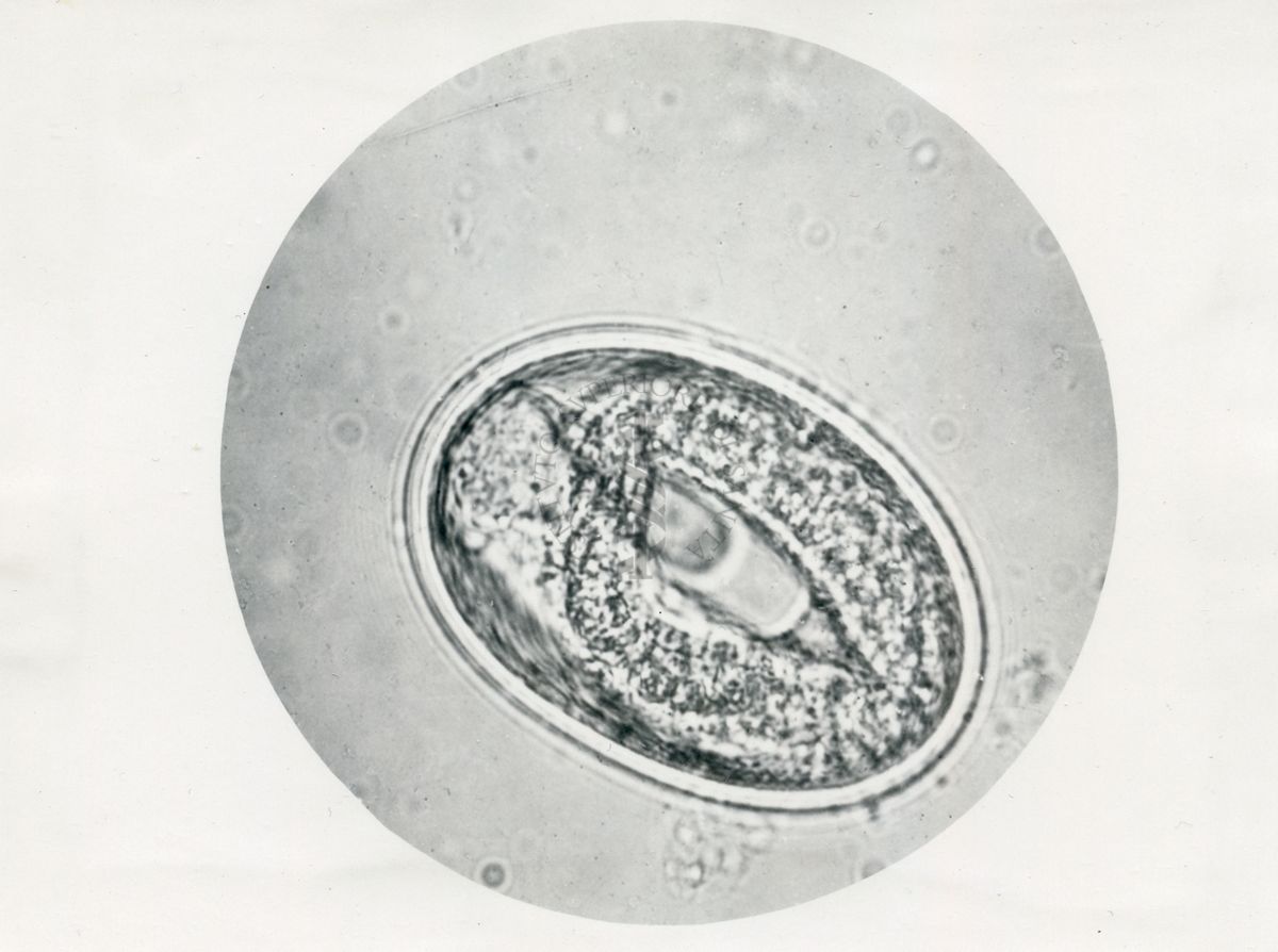 Ciclo di sviluppo dell'Ascaris lumbricoides