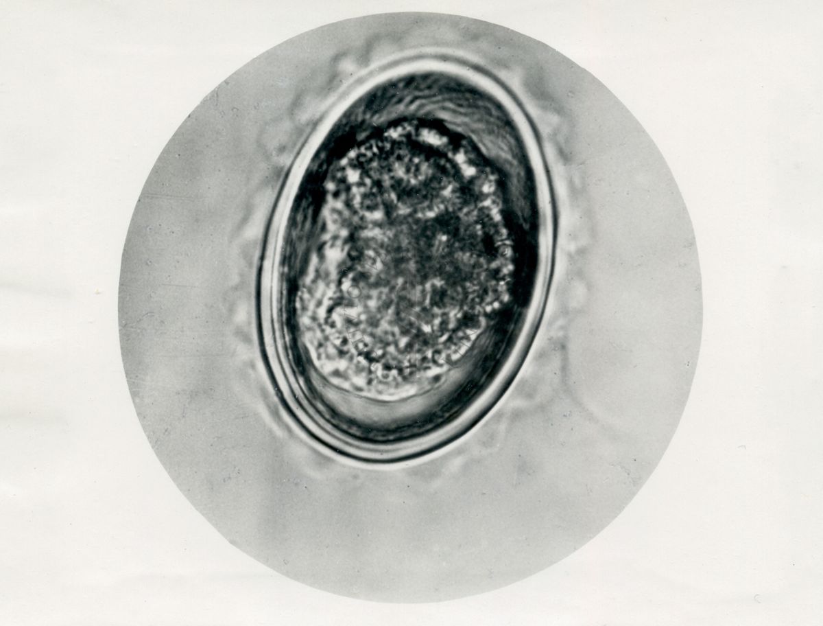 Ciclo di sviluppo dell'Ascaris lumbricoides