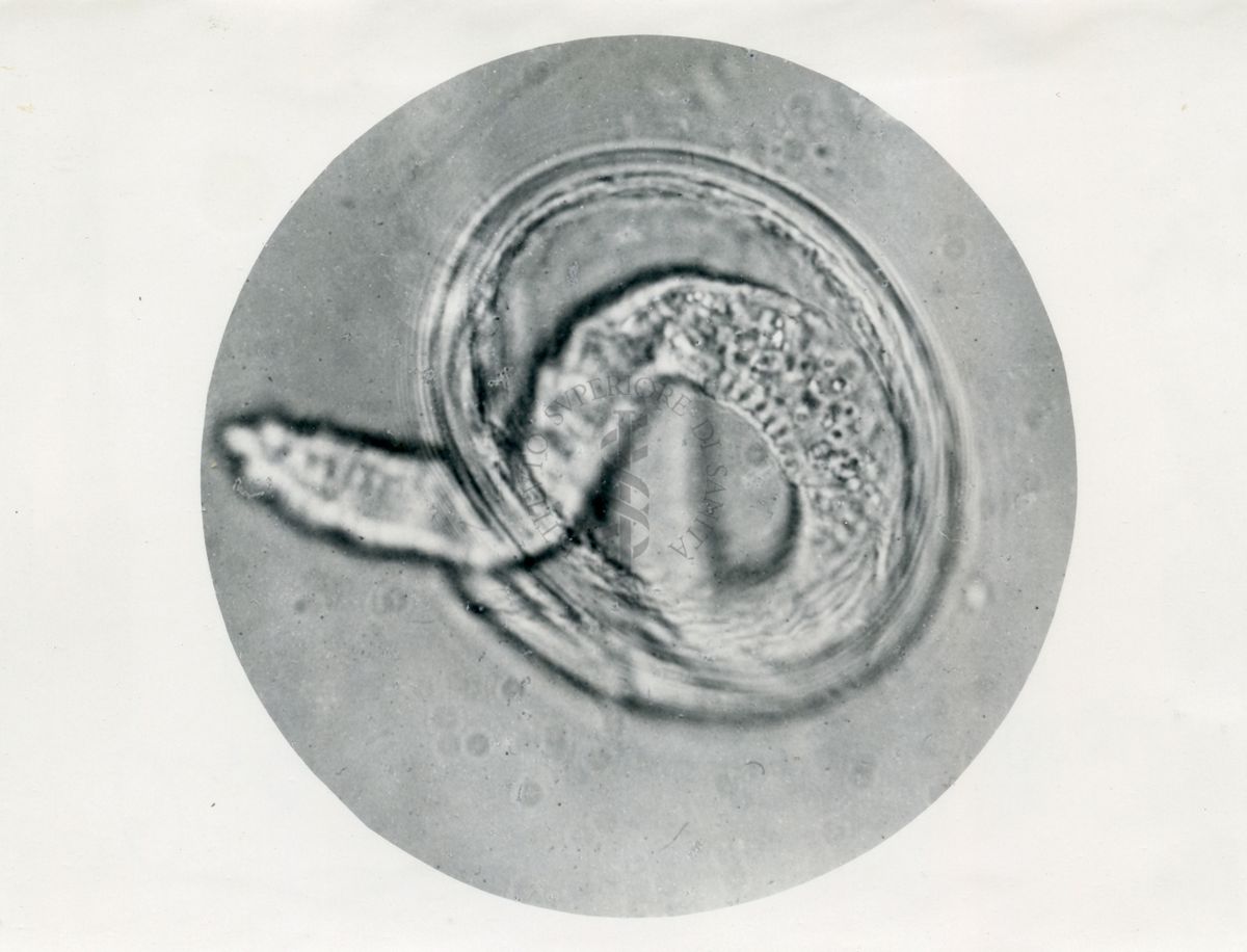 Ciclo di sviluppo dell'Ascaris lumbricoides