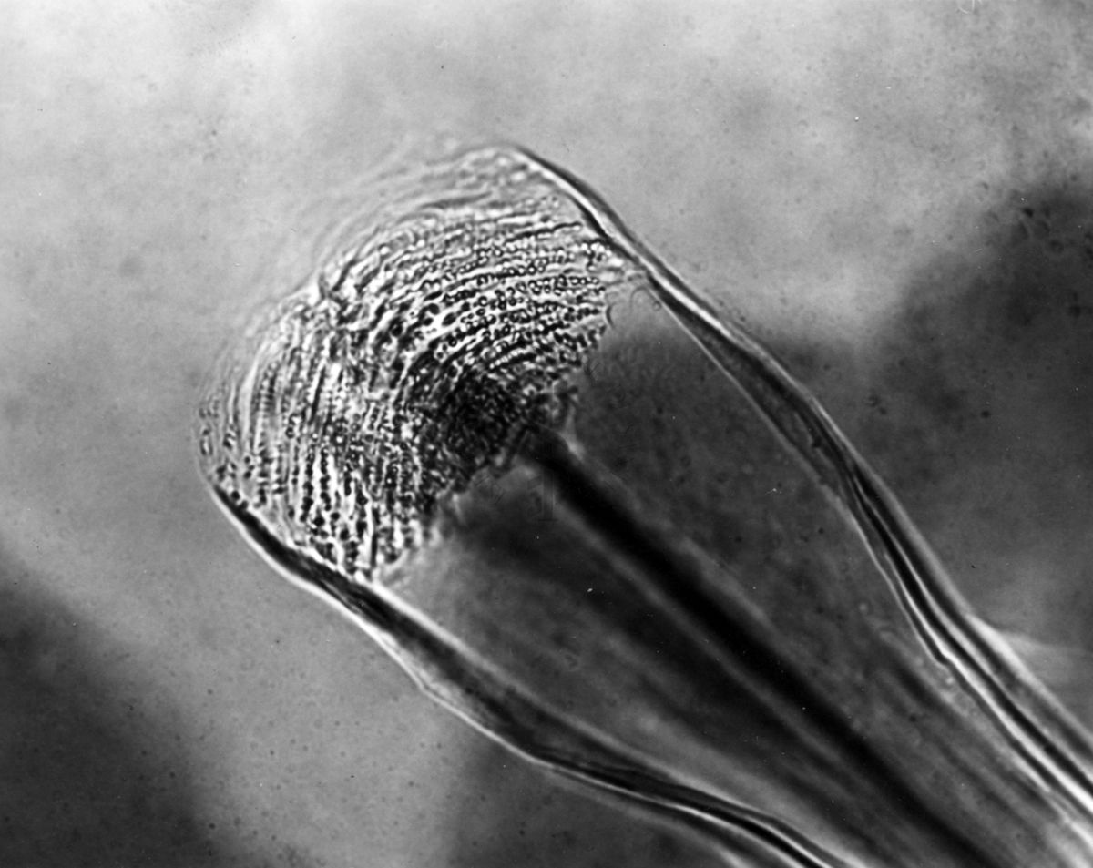 Differenze morfologiche fra le specie Ph. Perniciosus e Ph. Perfiliewi