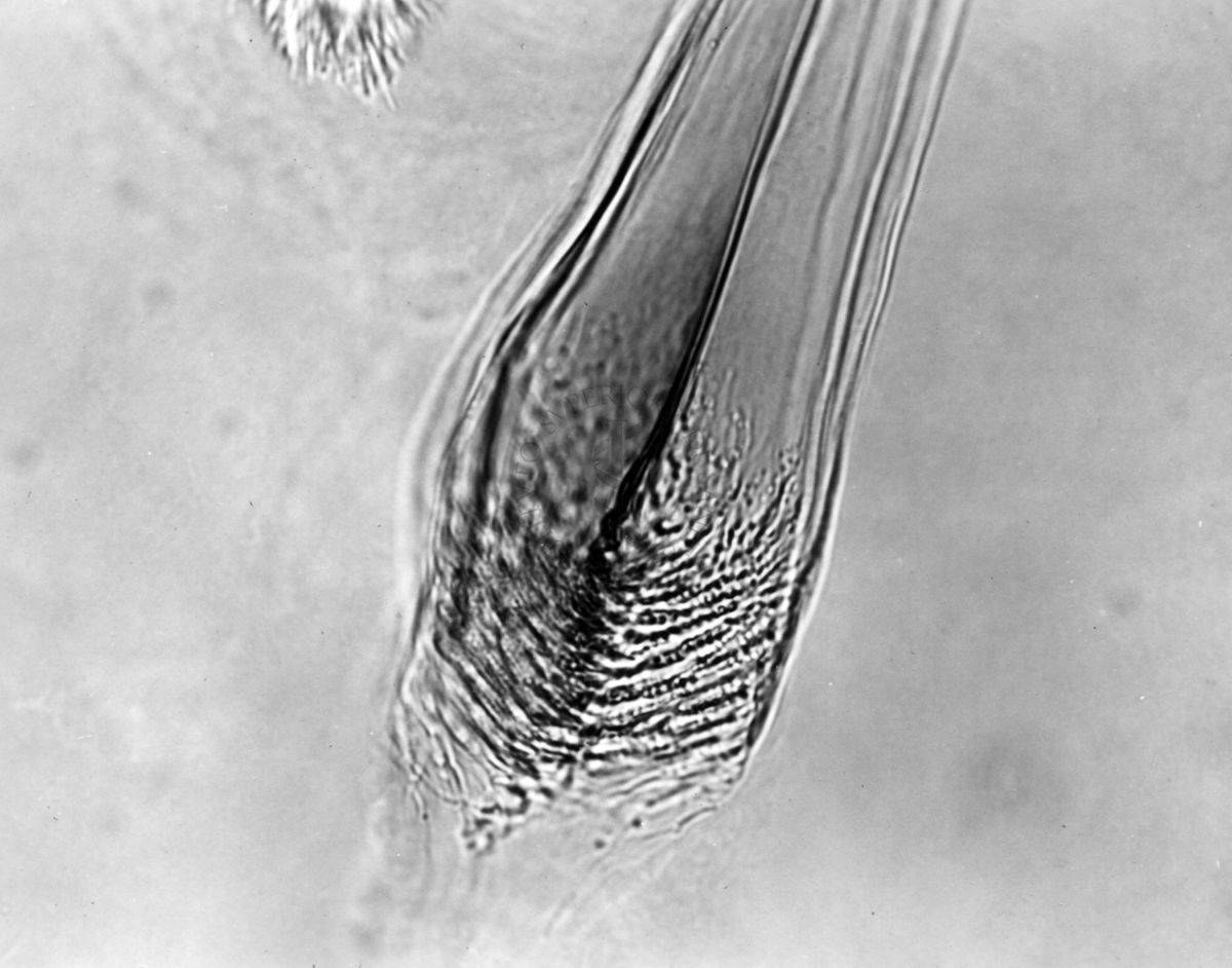 Differenze morfologiche fra le specie Ph. Perniciosus e Ph. Perfiliewi