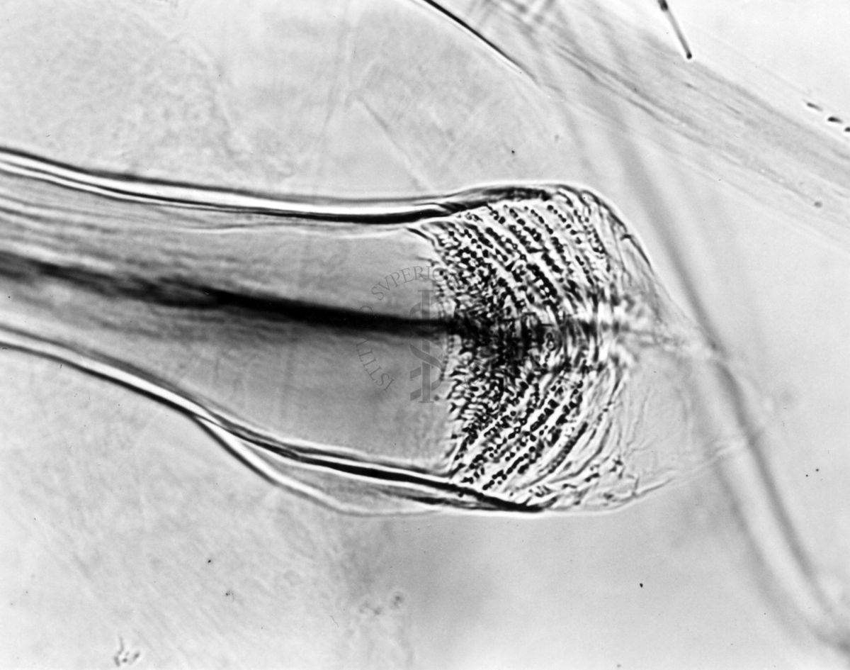 Differenze morfologiche fra le specie Ph. Perniciosus e Ph. Perfiliewi