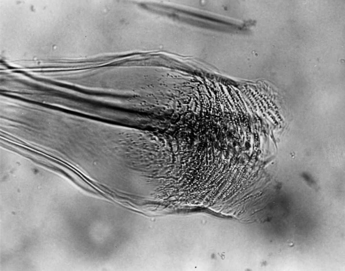 Differenze morfologiche fra le specie Ph. Perniciosus e Ph. Perfiliewi