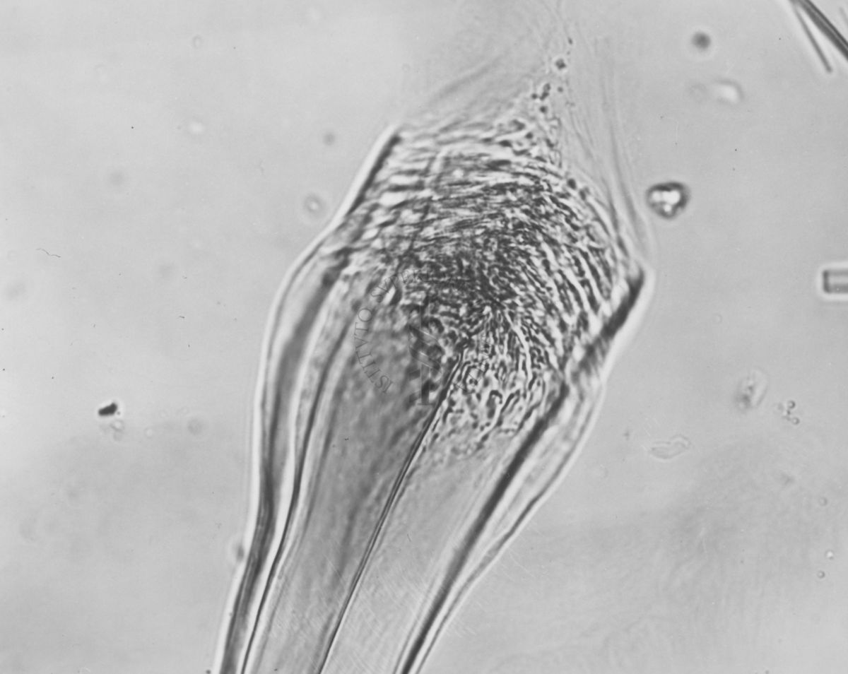 Differenze morfologiche fra le specie Ph. Perniciosus e Ph. Perfiliewi