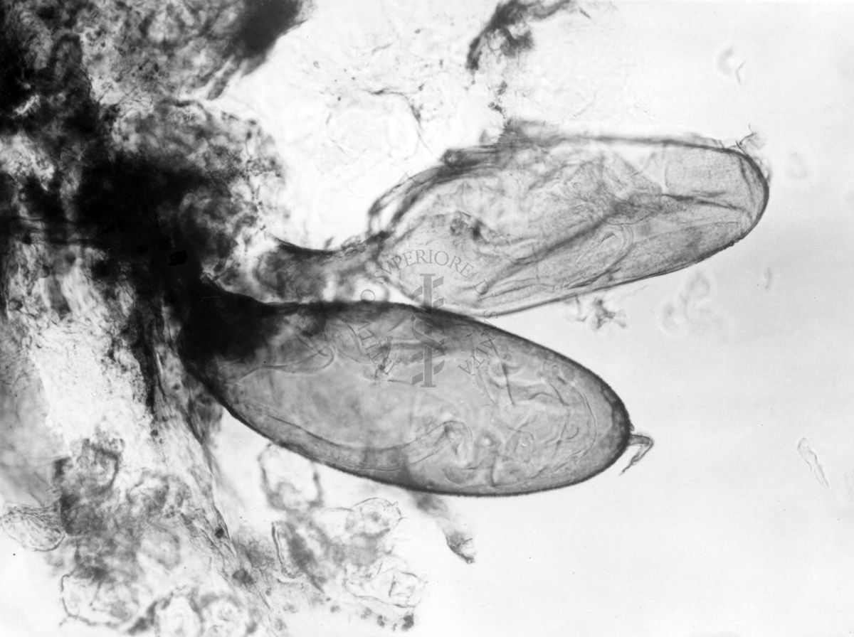 Uova e larve di imenotteri parassiti