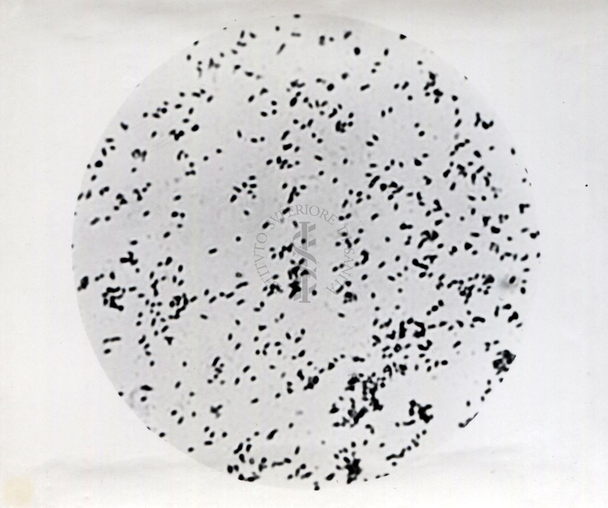 Immagini di Mycobacterium phlei