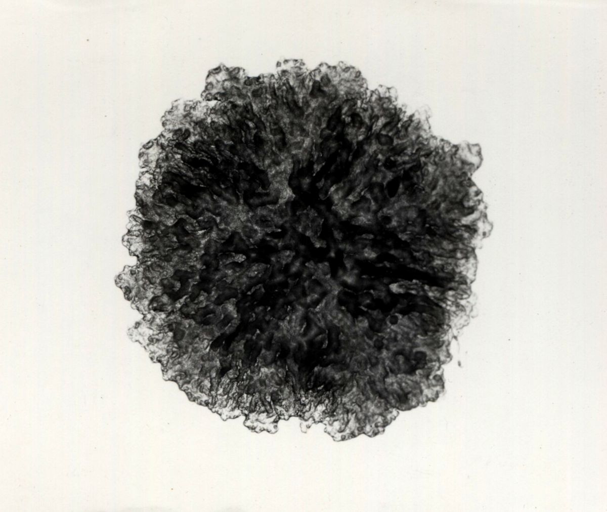 Immagini di Mycobacterium phlei
