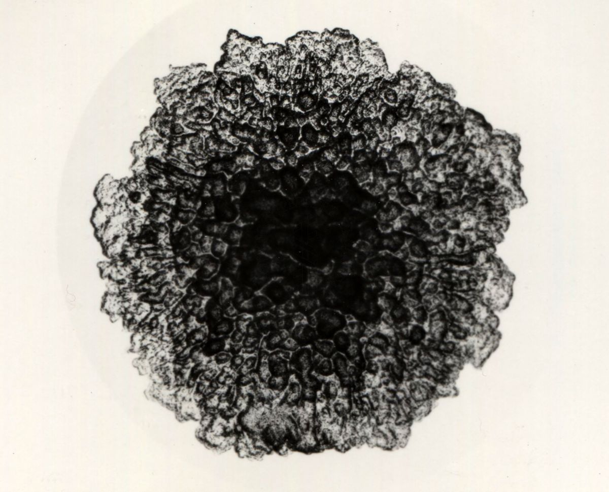 Immagini di Mycobacterium phlei