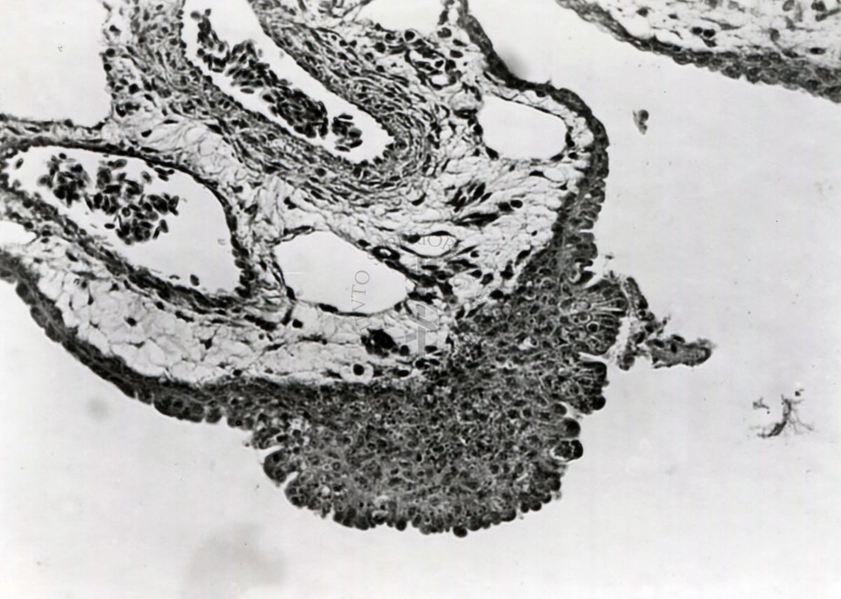 Sezione istologica di membrana corio-allantoidea (trovabile nelle uova di uccelli e rettili formata dalla fusione del mesoderma di 2 strutture embriologiche: allantoide e il corion) inoculata con materiale penfigoso