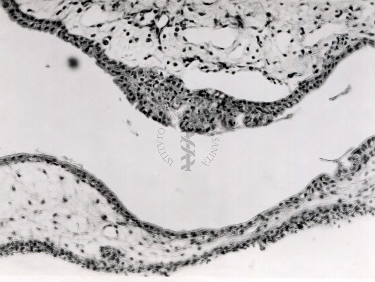 Sezione istologica di membrana corio-allantoidea (trovabile nelle uova di uccelli e rettili formata dalla fusione del mesoderma di 2 strutture embriologiche: allantoide e il corion) inoculata con materiale penfigoso