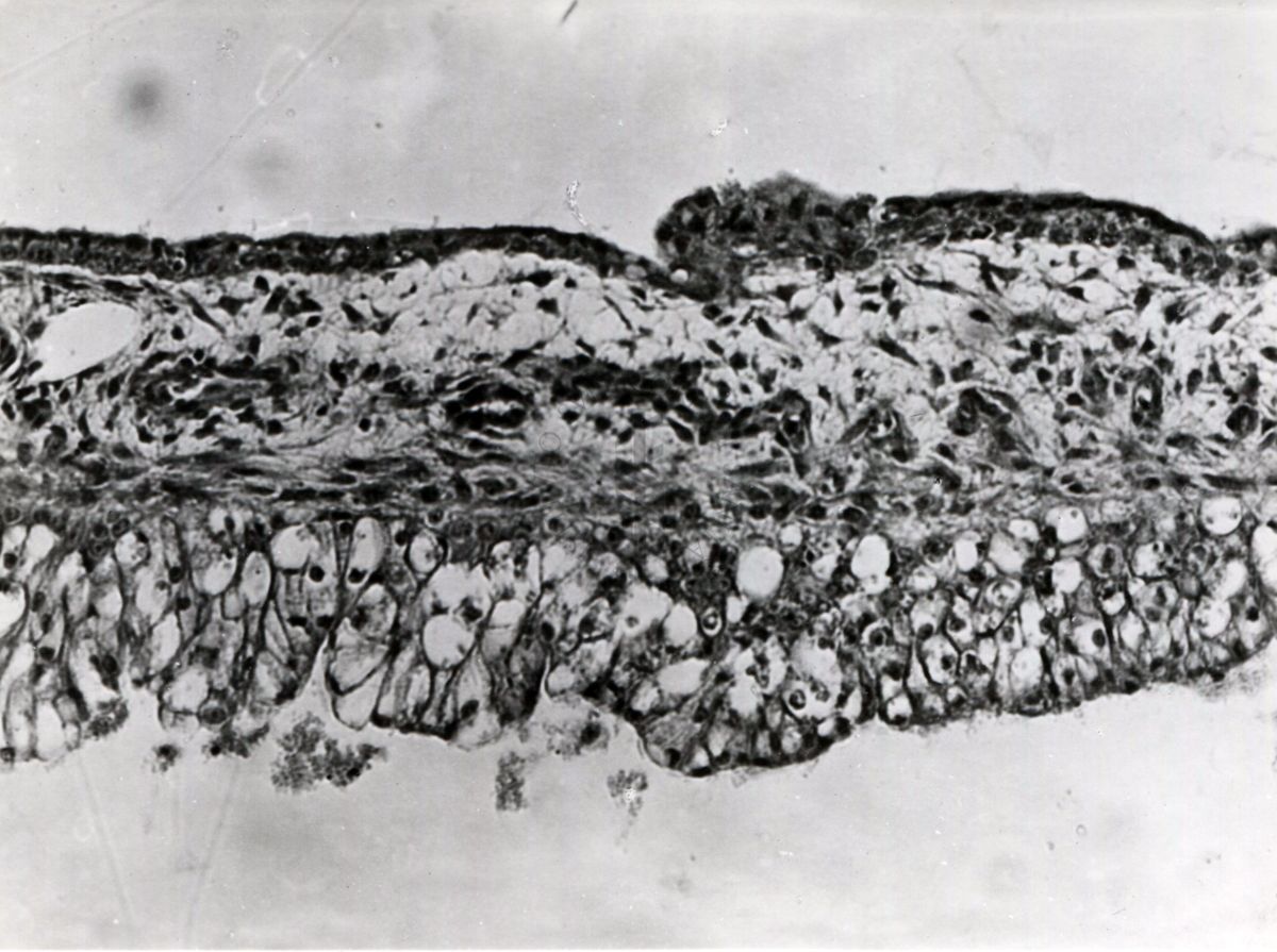 Sezione istologica di membrana corio-allantoidea (trovabile nelle uova di uccelli e rettili formata dalla fusione del mesoderma di 2 strutture embriologiche: allantoide e il corion) inoculata con materiale penfigoso