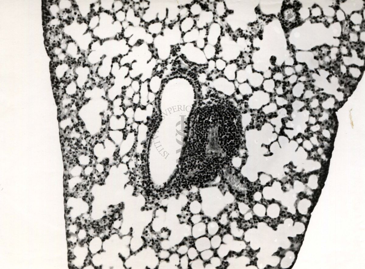 Sezioni di polmone di topino infettato con vino ornitoso (relativo ad ornitosi ovvero malattia provocata da un batterio gram-negativo e appartenente al gruppo delle clamidie)