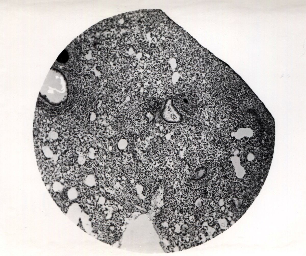 Sezioni di polmone di topino infettato con vino ornitoso (relativo ad ornitosi ovvero malattia provocata da un batterio gram-negativo e appartenente al gruppo delle clamidie)