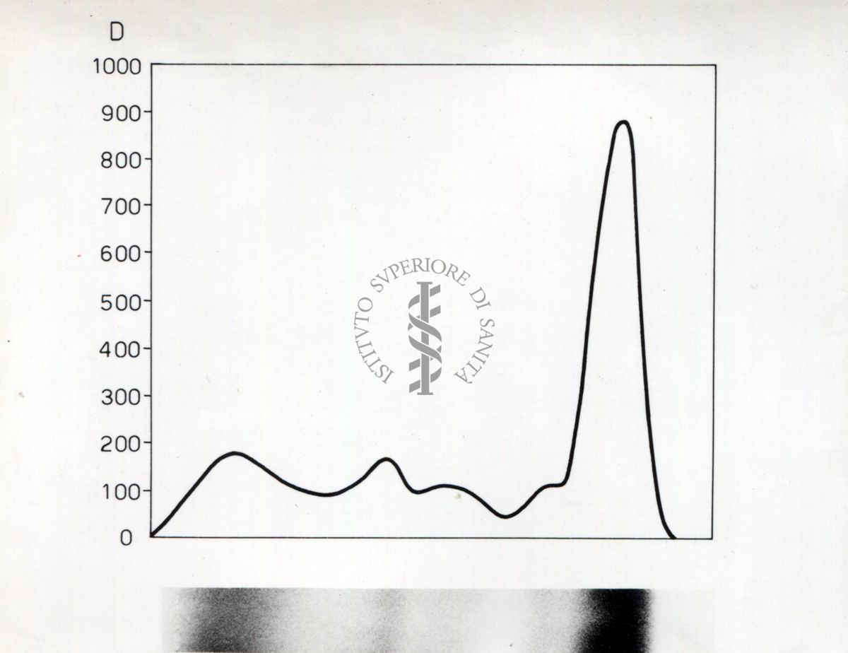 Grafico riguardante lo studio sulle proteine seriche in soggetti portatori di neoplasie trattati con raggi X