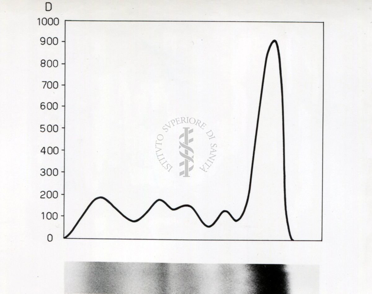 Grafico riguardante lo studio sulle proteine seriche in soggetti portatori di neoplasie trattati con raggi X