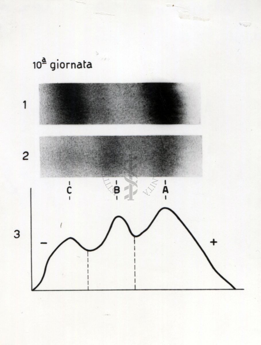 Elettroforesi di liquido allantoideo (riguardante un annesso embrionale) di embrione di pollo