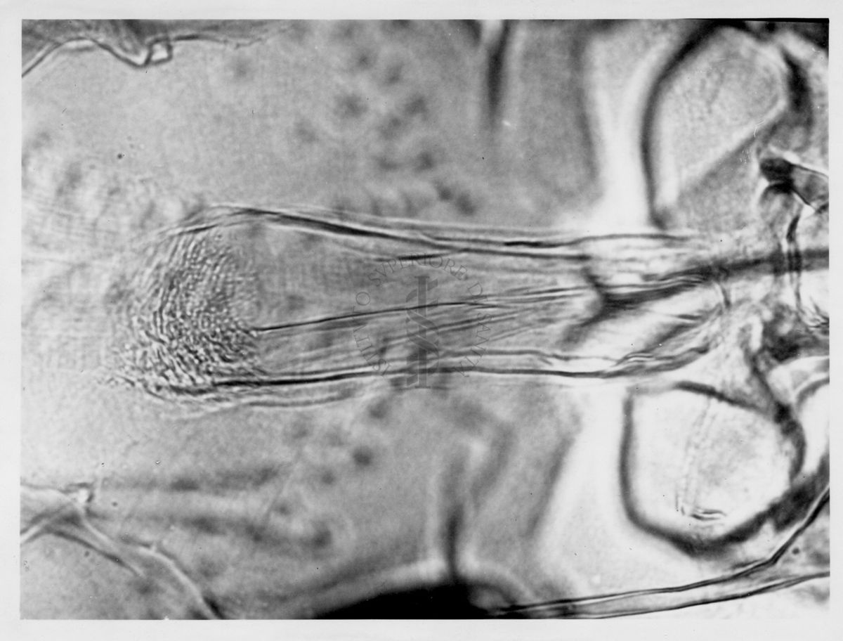 Immagine di differenze morfologiche fra le specie Phlebotomus perniciosus e Phlebotomus perfiliewi. Flebotomi.