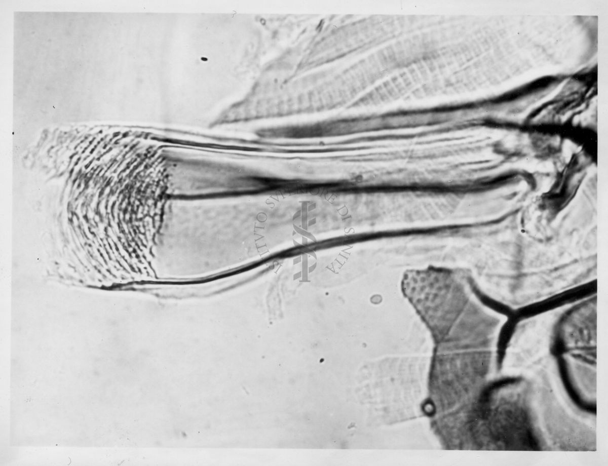 Immagine di differenze morfologiche fra le specie Phlebotomus perniciosus e Phlebotomus perfiliewi. Flebotomi.