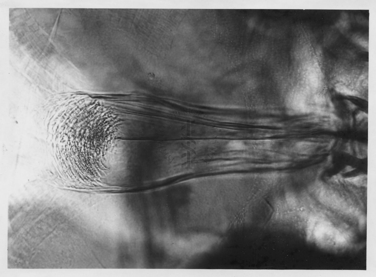 Immagine di differenze morfologiche fra le specie Phlebotomus perniciosus e Phlebotomus perfiliewi. Flebotomi.