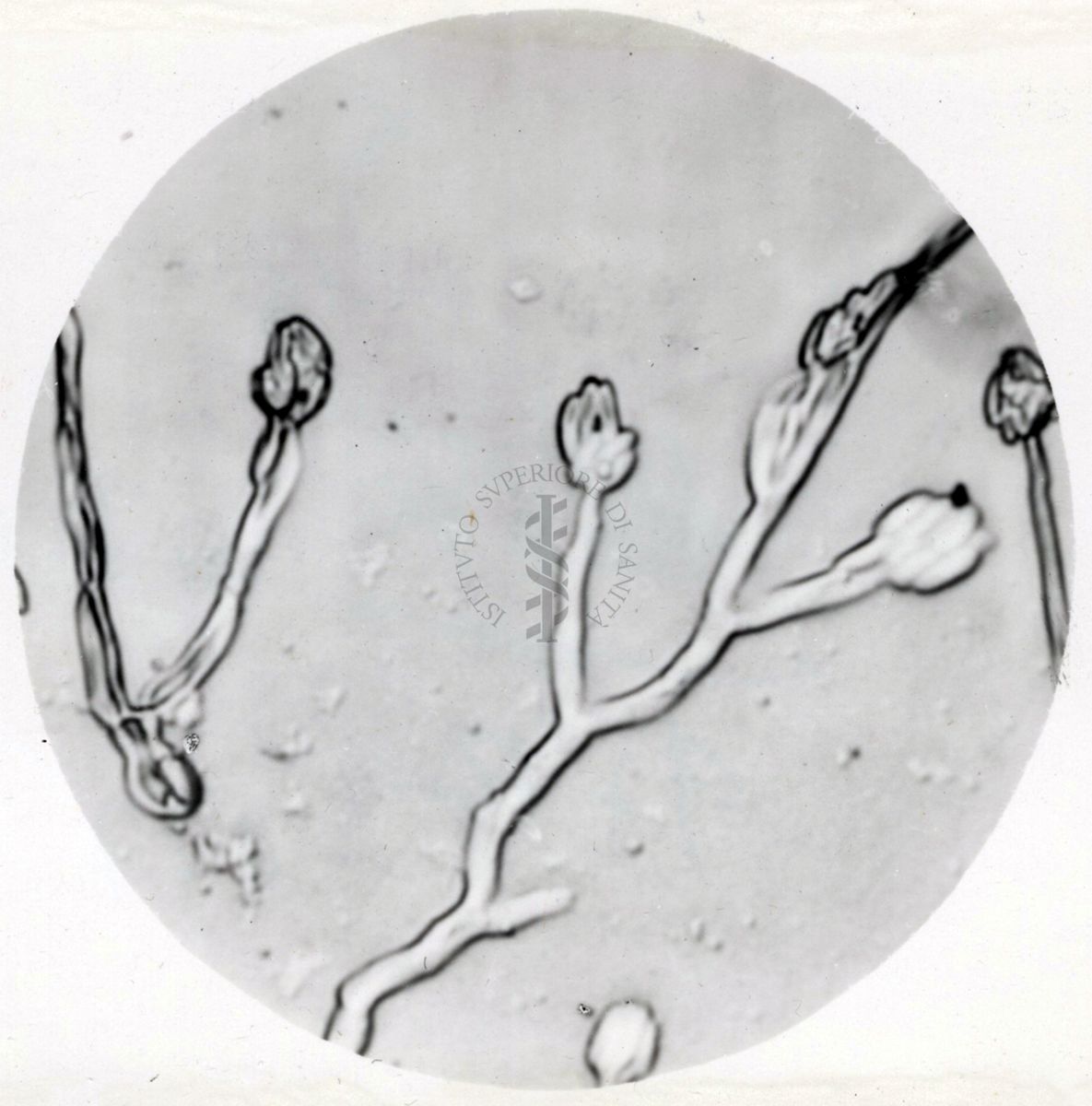 Saccaromiceti. Saccharomyces è un genere del regno dei funghi che include molte specie di lieviti. Il termine deriva dal latino: fungo dello zucchero.