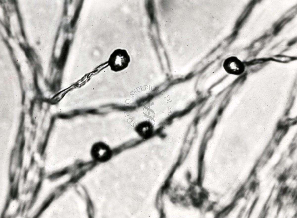 Saccaromiceti. Saccharomyces è un genere del regno dei funghi che include molte specie di lieviti. Il termine deriva dal latino: fungo dello zucchero.