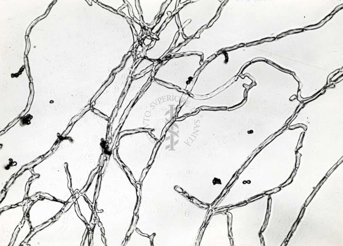 Saccaromiceti. Saccharomyces è un genere del regno dei funghi che include molte specie di lieviti. Il termine deriva dal latino: fungo dello zucchero.