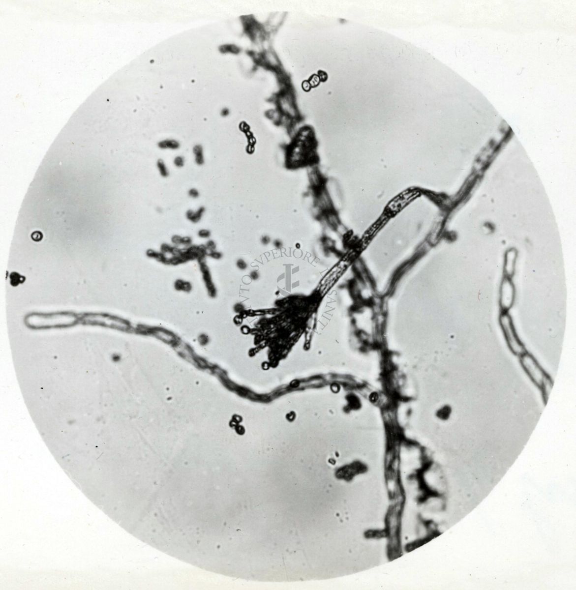 Saccaromiceti. Saccharomyces è un genere del regno dei funghi che include molte specie di lieviti. Il termine deriva dal latino: fungo dello zucchero.