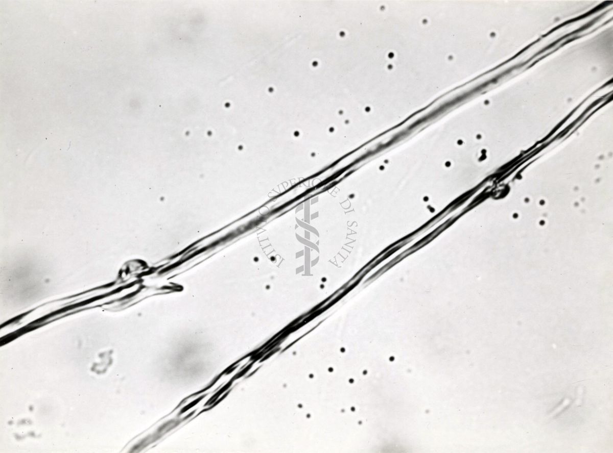 Saccaromiceti. Saccharomyces è un genere del regno dei funghi che include molte specie di lieviti. Il termine deriva dal latino: fungo dello zucchero.