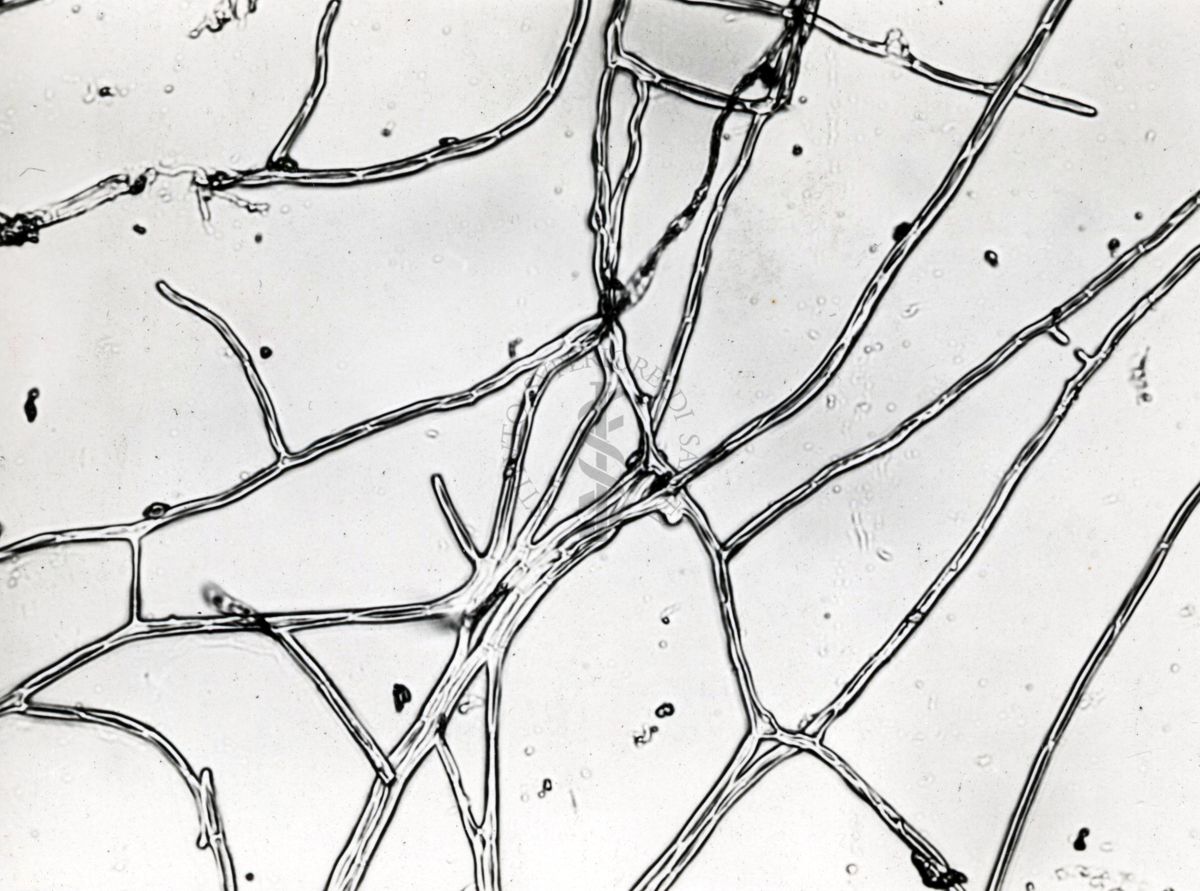 Saccaromiceti. Saccharomyces è un genere del regno dei funghi che include molte specie di lieviti. Il termine deriva dal latino: fungo dello zucchero.