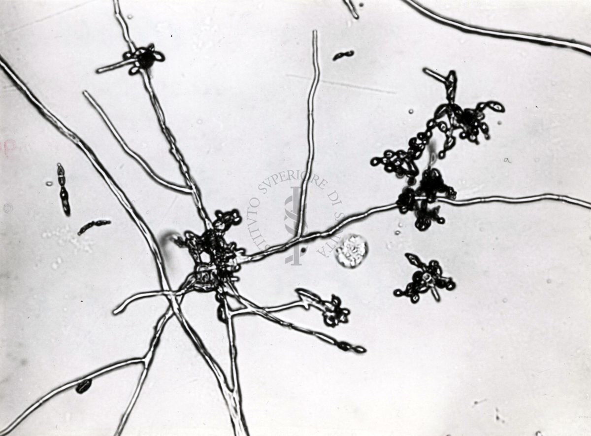 Saccaromiceti. Saccharomyces è un genere del regno dei funghi che include molte specie di lieviti. Il termine deriva dal latino: fungo dello zucchero.