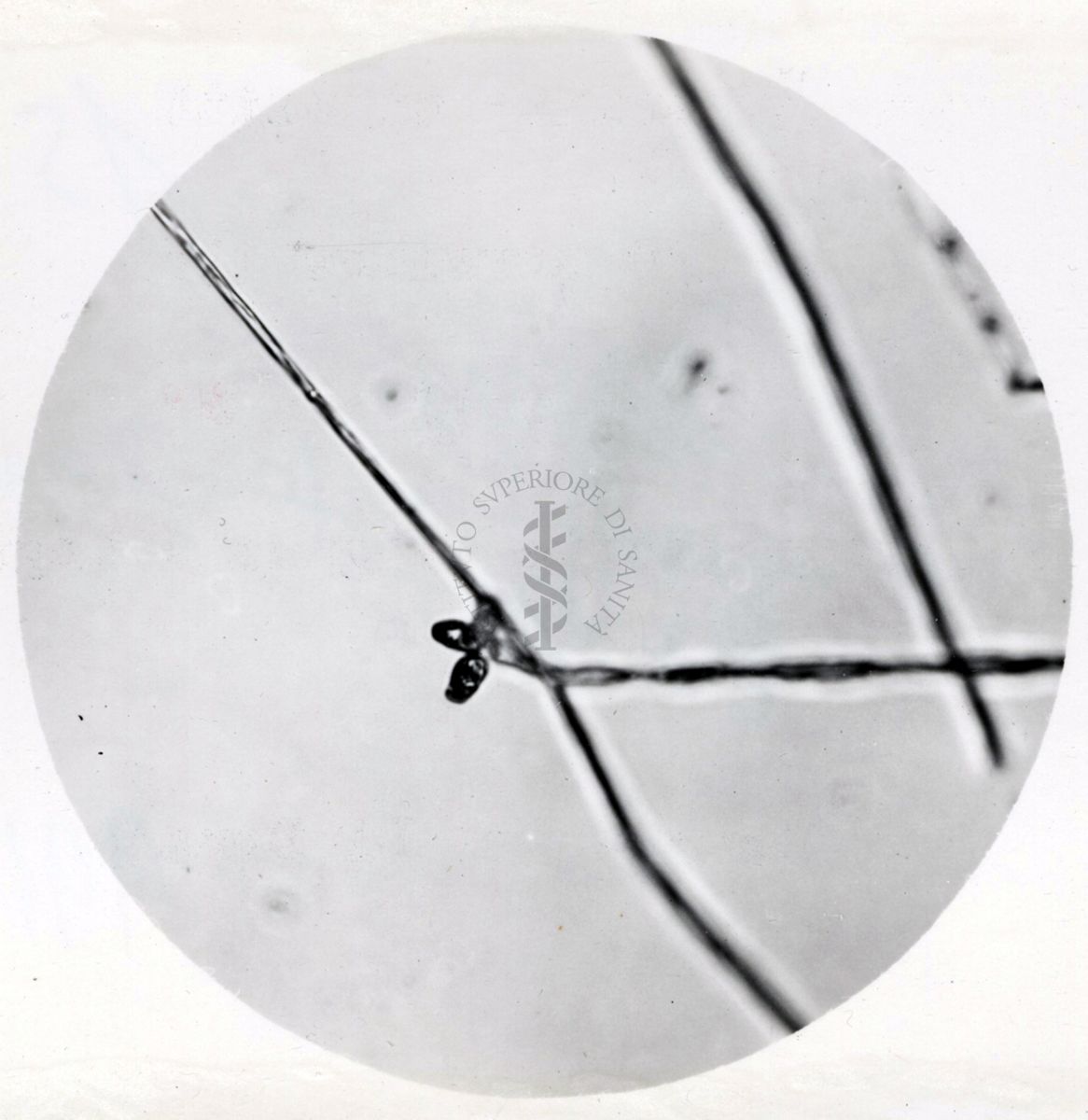 Saccaromiceti. Saccharomyces è un genere del regno dei funghi che include molte specie di lieviti. Il termine deriva dal latino: fungo dello zucchero.