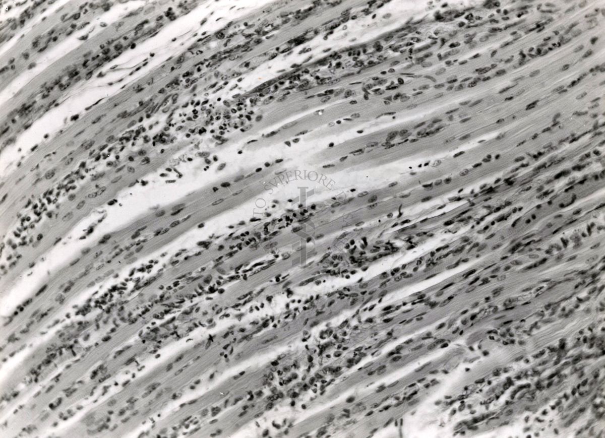 Miosite da virus Coxsackie in topino lattante. Le miositi sono un gruppo eterogeneo di malattie muscolari acquisite, accomunate dall'infiammazione del tessuto muscolare striato. Esse fanno parte del più ampio gruppo delle connettiviti , tra le cui forme rientrano le polimiosite e la dermatomiosite.