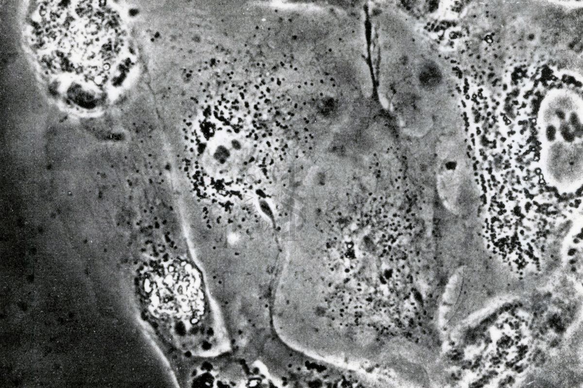 Coltura su tessuto del virus polio 26 dopo l'infezione