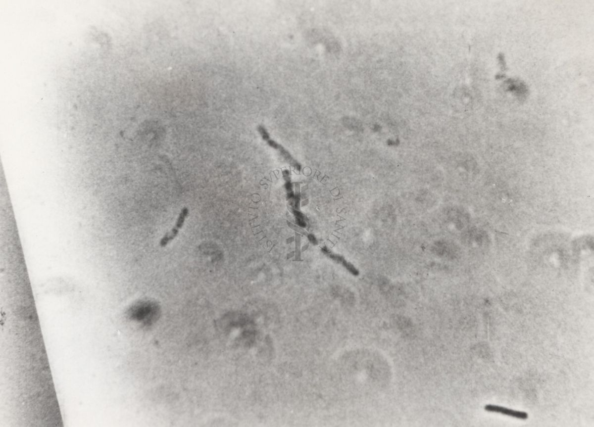 Differenti immagini del Batteriofago. Si tratta di un virus che infetta esclusivamente i batteri e sfrutta il loro apparato biosintetico per effettuare la replicazione virale.